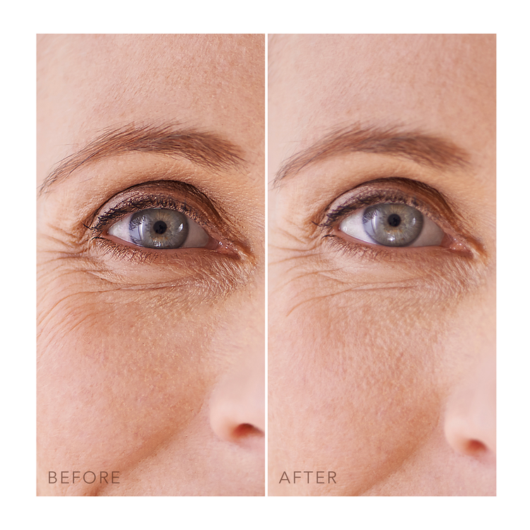 Iris Parches de hidrogel con musgo marino y colágeno