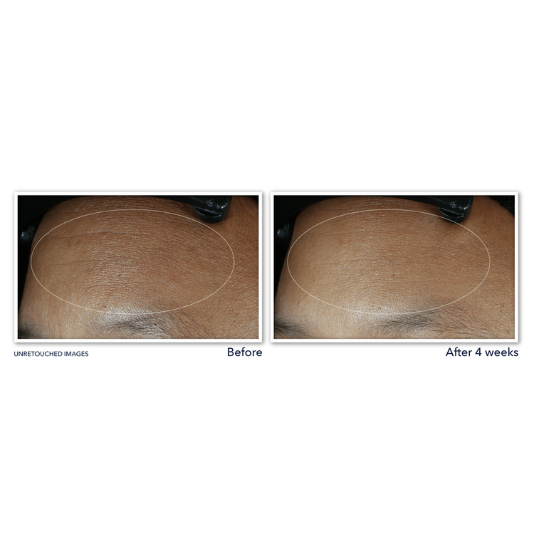 Retinol Correxion Line Smoothing Max Suero reduce signos de envejecimiento