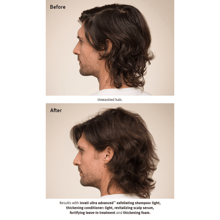 Invati Ultra Tratamiento fortalecedor evita la caida del cabello y engrosa la fibra capilar