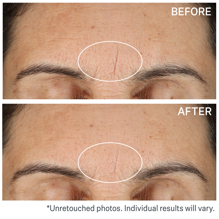 Line BlurFector Instant Wrinkle Blurring Prebase difuminadora rellena y difumina las arrugas