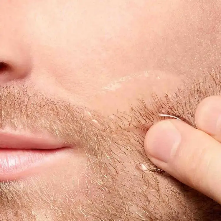 Men After Shave - Tónico calmante post afeitado, protege conta la irritación