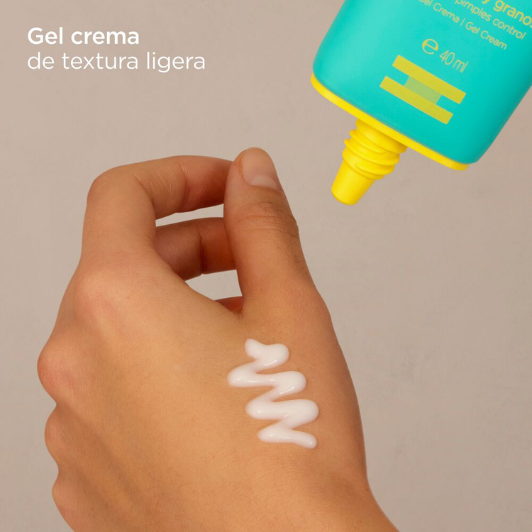 Acniben Crema facial regula el exceso de sebo y matifica la piel