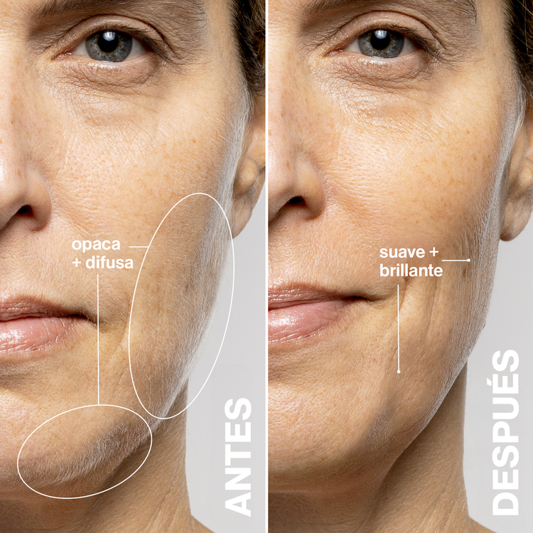 Luxe+ Advanced Sonic - Exfoliador y masajeador sónico, elimina impurezas y mejora la piel