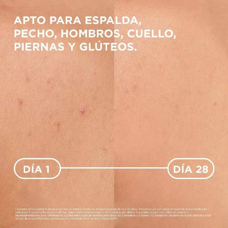 Sébium Kerato + Body - Spray corporal, anti-imperfecciones