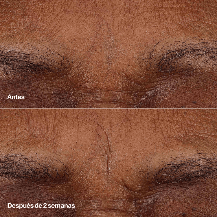 Smart Clinical Repair Retinoid - Bálsamo anti-envejecimiento, suaviza y rellena líneas finas