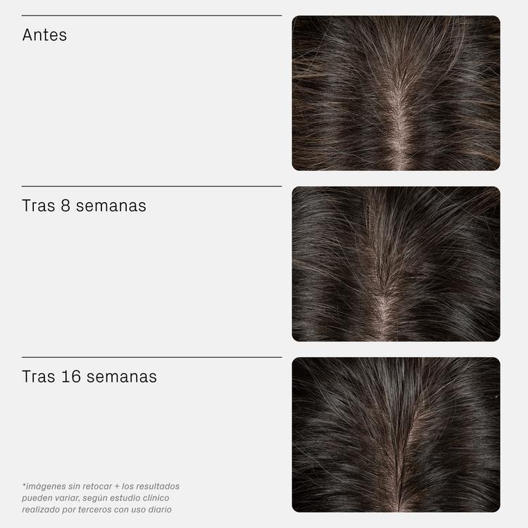 Iconic - Suero capilar, hidrata el cuero cabelludo