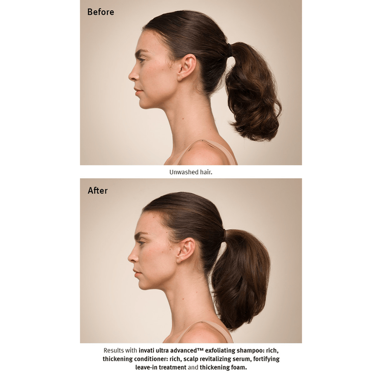 Invati Ultra Espuma evita la caida del cabello y engrosa la fibra capilar