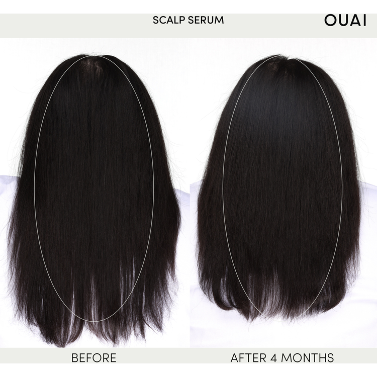Scalp - Suero, hidrata el cuero cabelludo