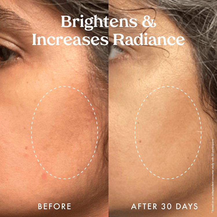 Star Bright Vitamin C - Suero antimanchas, hidrata la piel