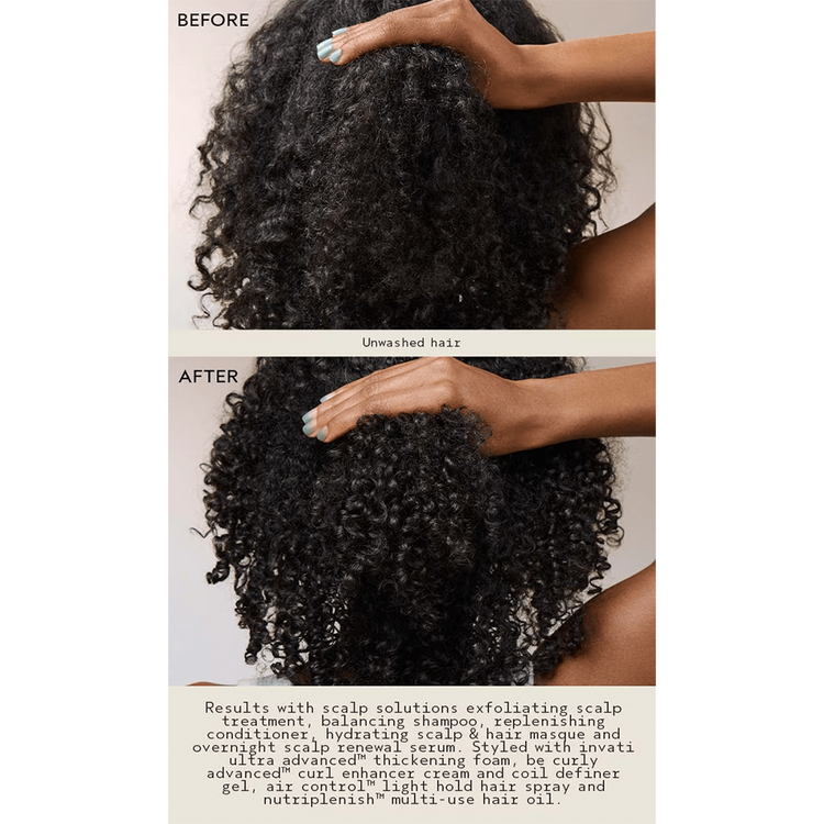 Scalp Advanced Mascarilla hidrata y cuida el cuero cabelludo