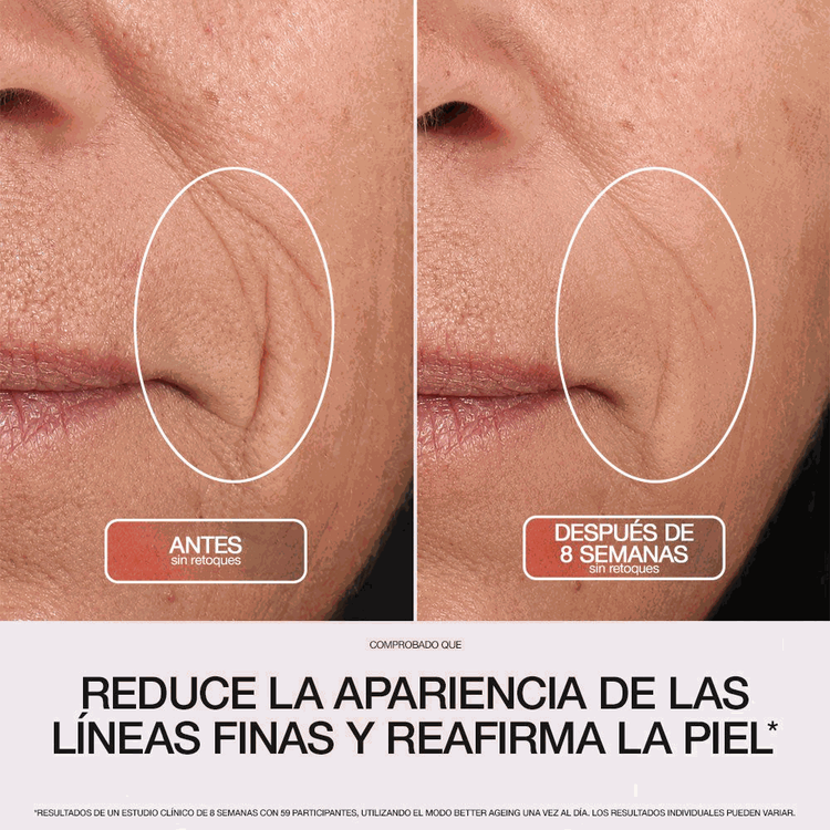Shark CryoGlow™ Plus - Máscara LED, antiedad y anti-imperfecciones