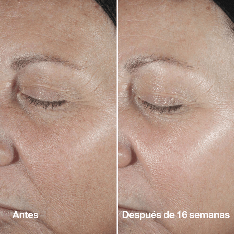 Smart Clinical Repair™ Wrinkle - Suero antiarrugas, ataca líneas de expresión y arrugas