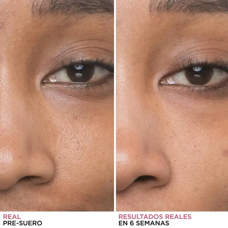 Bye Bye Serum Suero facial mejora visiblemente la textura de la piel con sensación de flexibilidad