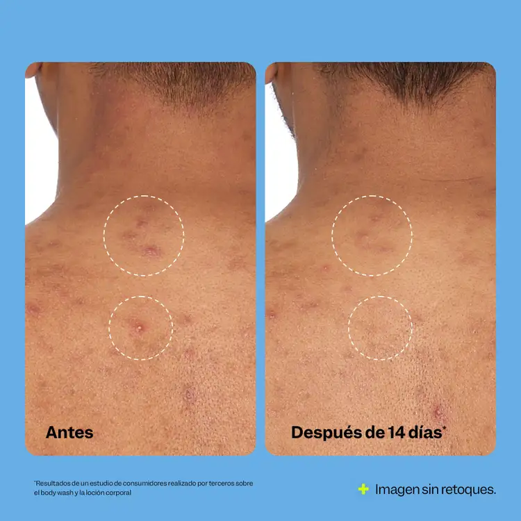 Breakout Banisher - Gel de ducha, ideal para exfoliar