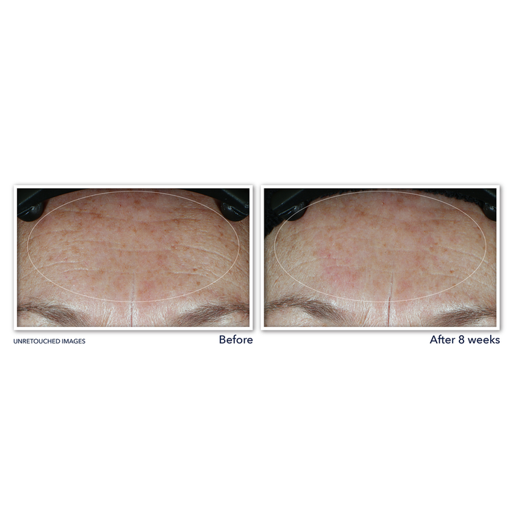 Multi Correxion Hyaluronic Acid Hidratante hidrata la piel