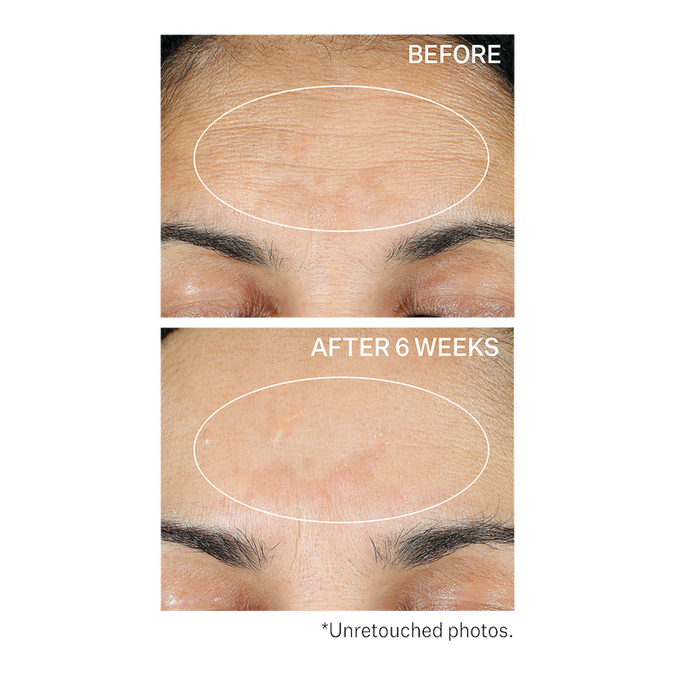 Super-C Retinol Brighten & Correct Vitamin C Suero iluminador ilumina la piel