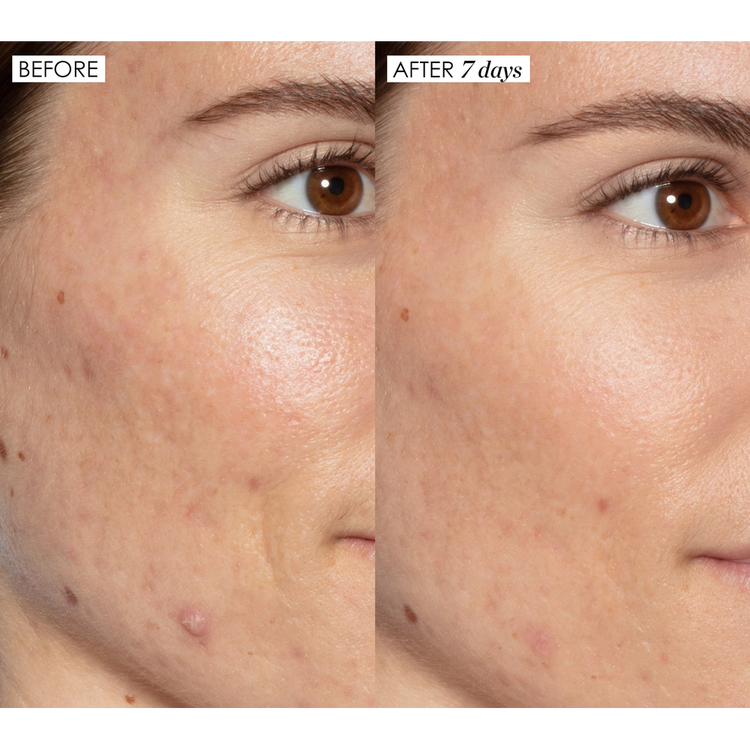 Good Genes All-In-One - Suero multitratamiento, exfolia y rellena la piel