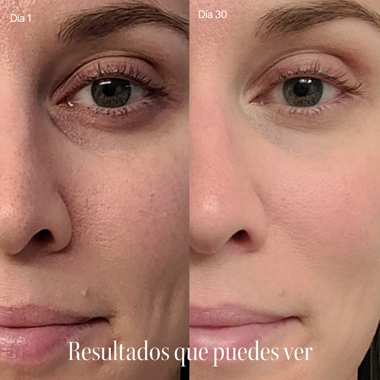 Solawave Gold Wand - Kit Sérum Activo, con tecnología de luz roja y microcorrientes - 4 piezas