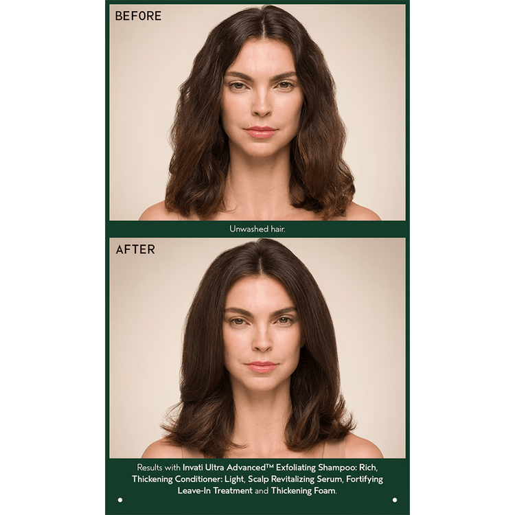 Invati Ultra Acondicionador evita la caída y engrosa el cabello