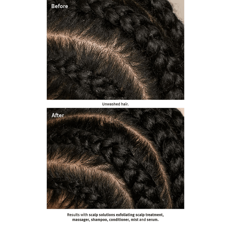 Scalp Advanced Estimulador de cuero cabelludo hidrata y cuida el cuero cabelludo