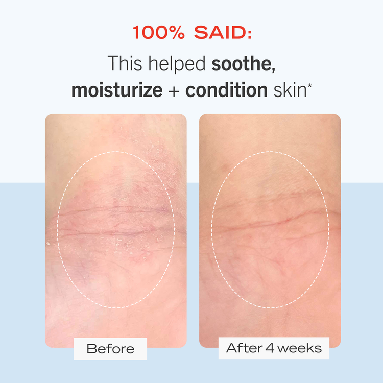 Ultra Repair - Crema hidratante, hidratación intensiva
