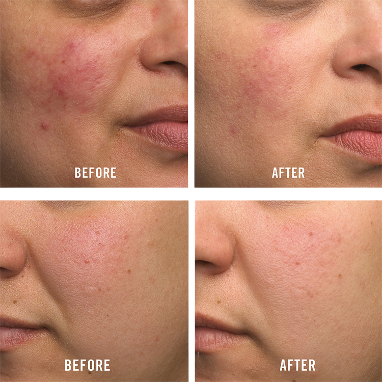 Travel Size Ultra Repair Cream Intense Hydration Crema hidratante intensiva hidratación profunda e inmediata