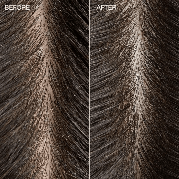 Tea Tree Special Detox Foaming Salt Scrub Enjuague exfoliante exfolia y limpia el cuero cabelludo