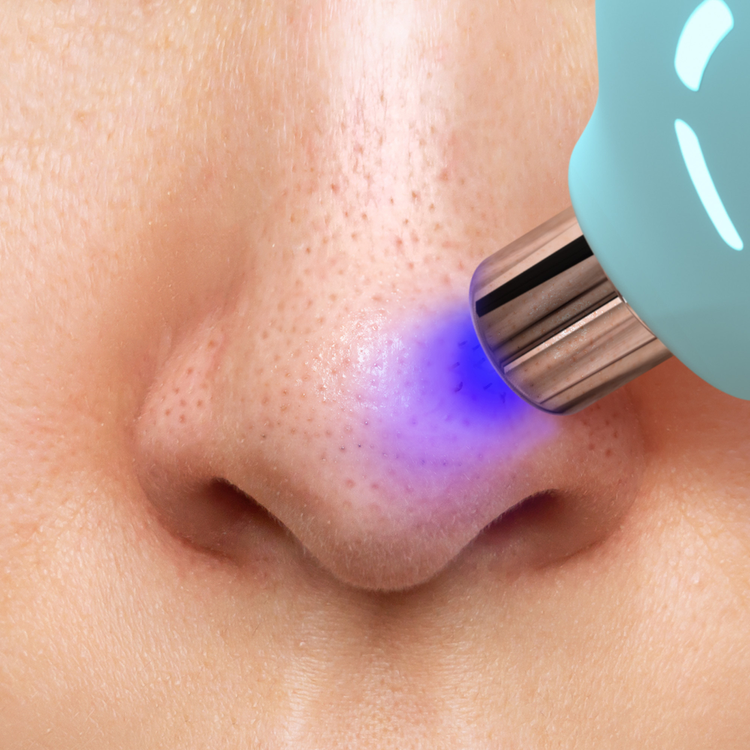 Kiwi Aspirador purificante de puntos negros para todo tipo de piel