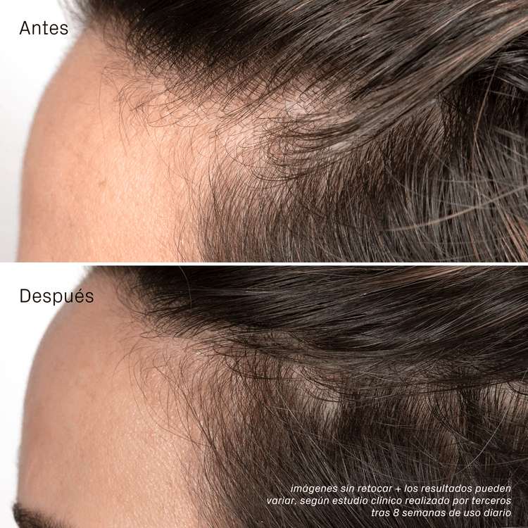 Iconic - Suero capilar, hidrata el cuero cabelludo