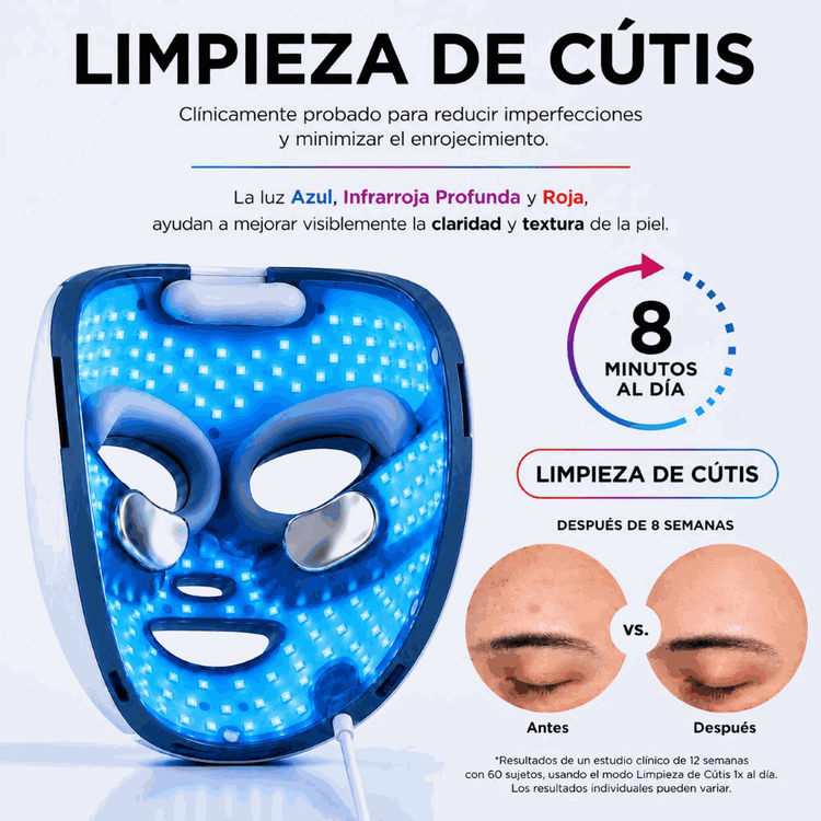 Shark CryoGlow™ Plus - Máscara LED, antiedad y anti-imperfecciones