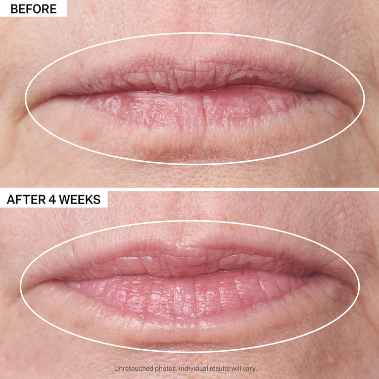 Double Fix for Lips Plumping & Vertical Line Tratamiento para labios suaviza los labios