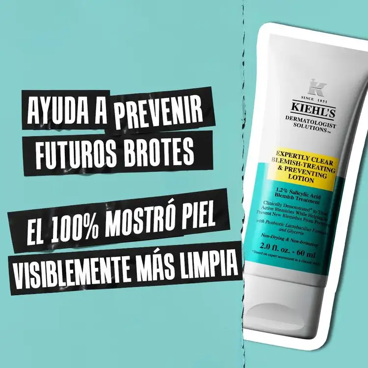 Acne Loción hidratante para acné con ácido salicílico al 1.2%