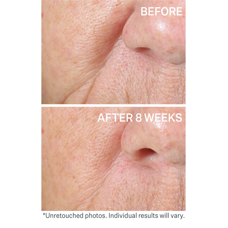 Peptight Face Lift Suero redefine el contorno del rostro