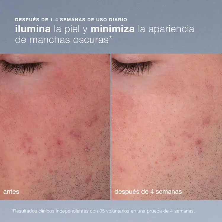 Daily Microfoliant Exfoliator Exfoliante disminuye las imperfecciones