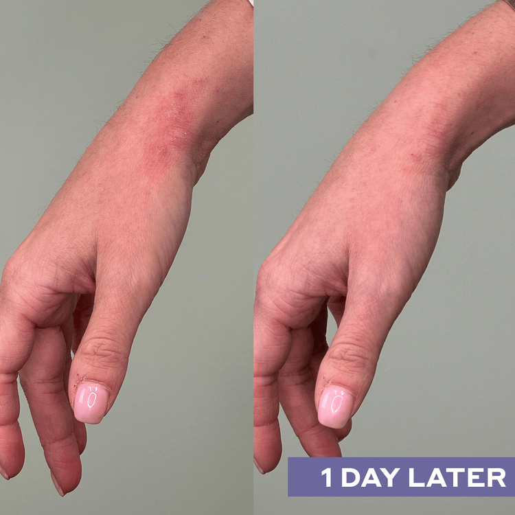 Hypochlorous Acid Spray facial reparador limpia las impurezas