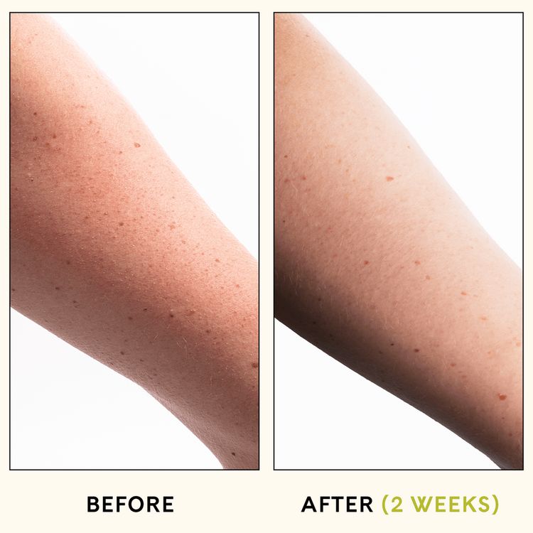 Kp Exfoliante corporal limpieza profunda