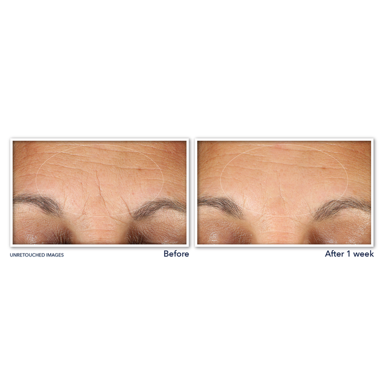 Multi Correxion Hydrate + Plump Hyaluronic Acid Crema/gel para ojos levanta y reafirma contorno de ojos