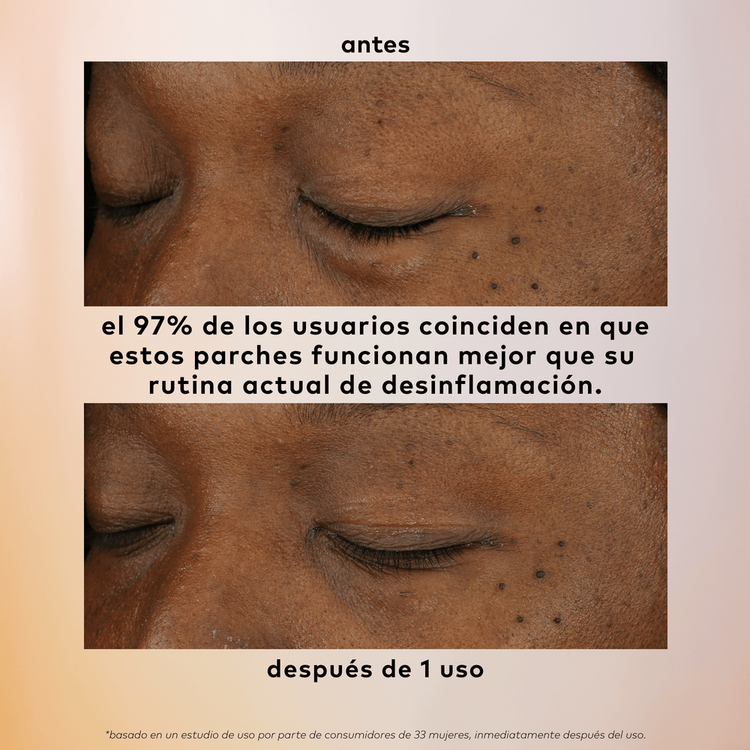 De-Puff Hydrogel - Parches de ojos, refrescantes para el contorno de ojos