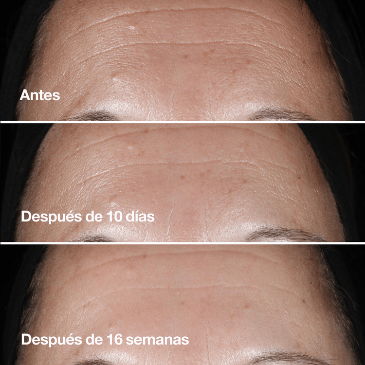 Smart Clinical Repair™ Wrinkle - Suero antiarrugas, ataca líneas de expresión y arrugas