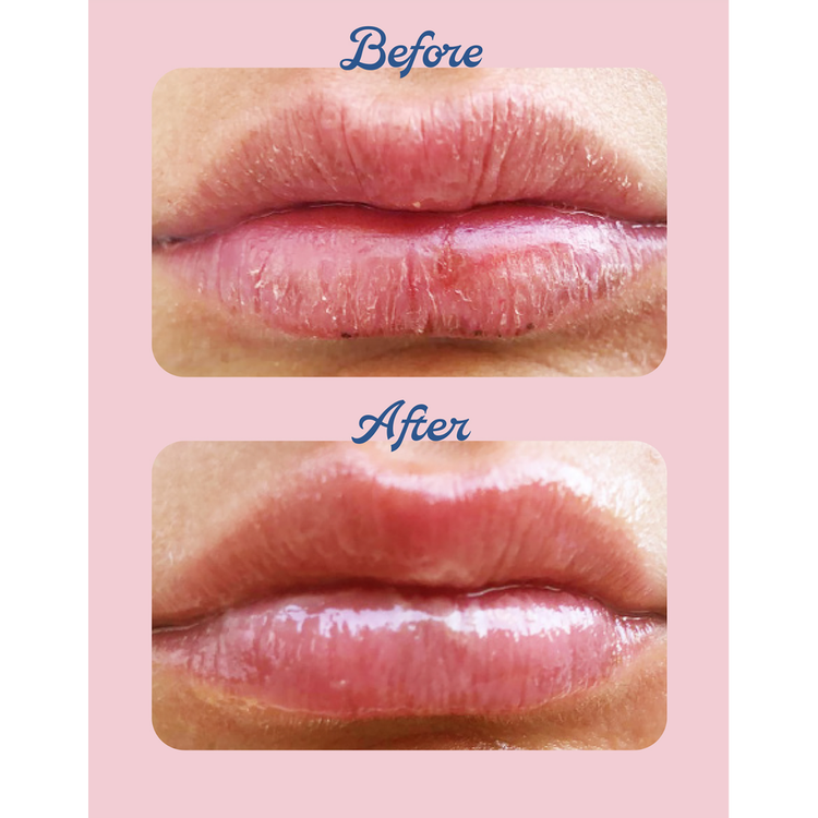 Strawberry 101 Ointment Multi-Balm - Dry Lips Treatment Bálsamo para labios secos hidrata los labios