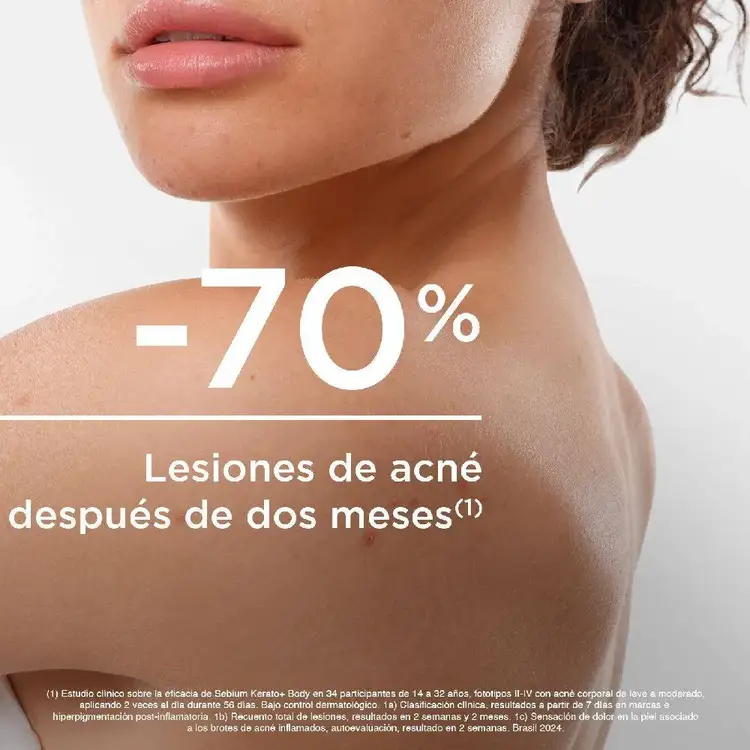 Sébium Kerato + Body - Spray corporal, anti-imperfecciones