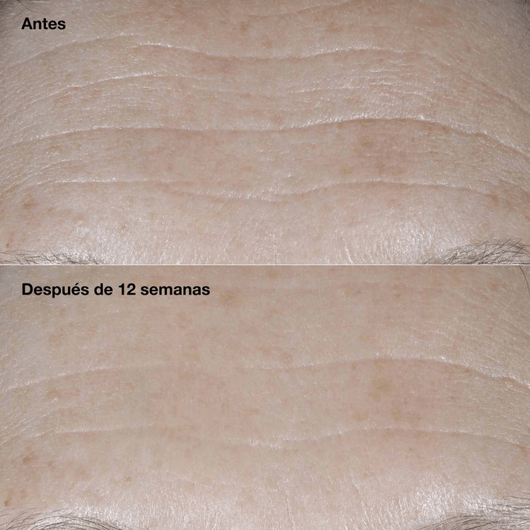 Smart Clinical Repair™ Wrinkle Correcting Cream Spf 50 Crema repara visiblemente las arrugas