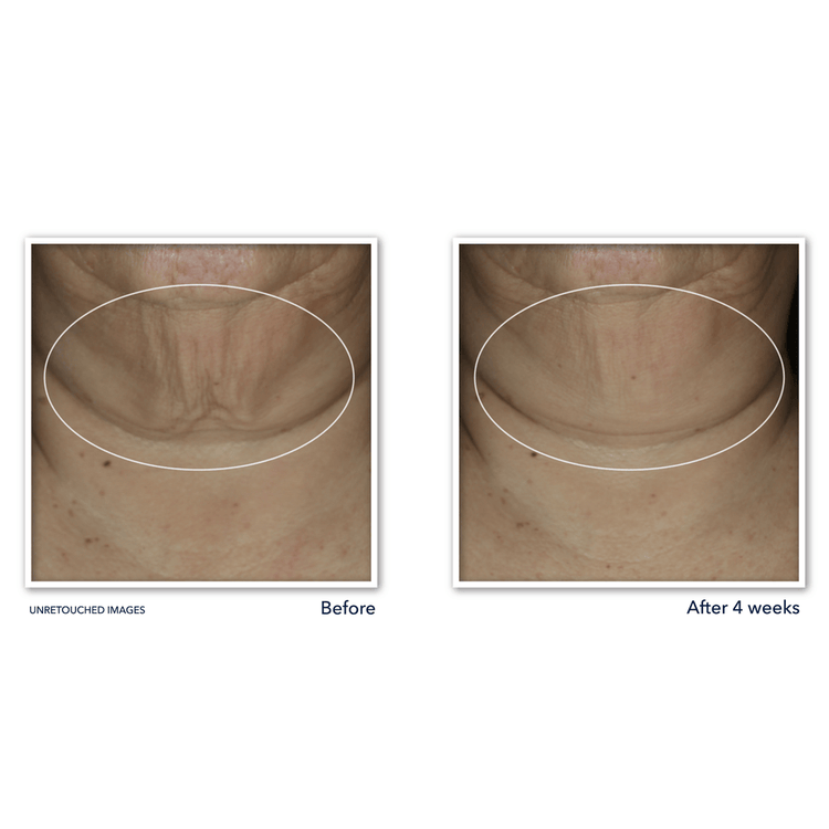 Derm Correxion Firming - Suero en barra, trata las líneas de expresión