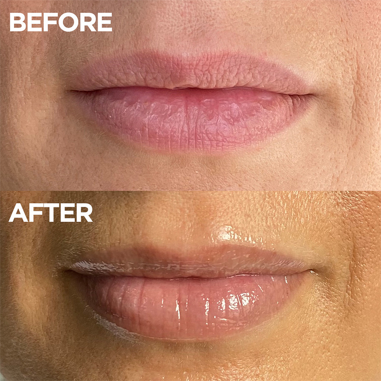 The Original 101 Ointment Multipurpose Superbalm Bálsamo multipropósito hidrata los labios