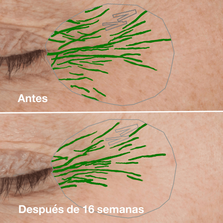 Smart Clinical Repair™ Wrinkle - Suero antiarrugas, ataca líneas de expresión y arrugas
