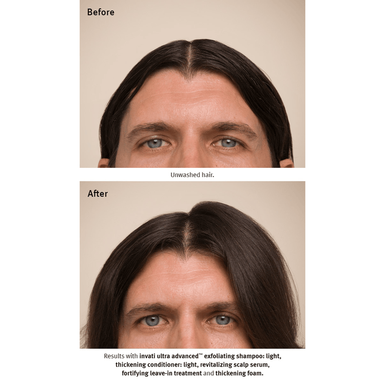 Invati Ultra Acondicionador ligero evita la caida del cabello y engrosa la fibra capilar