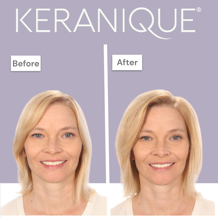 Volumizing Follicle Strengthening Acondicionador voluminiza tu cabello