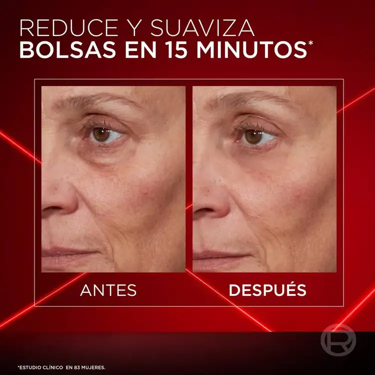 Revitalift Laser - Borrador de bolsas para ojos, reduce visiblemente las bolsas 15 ml