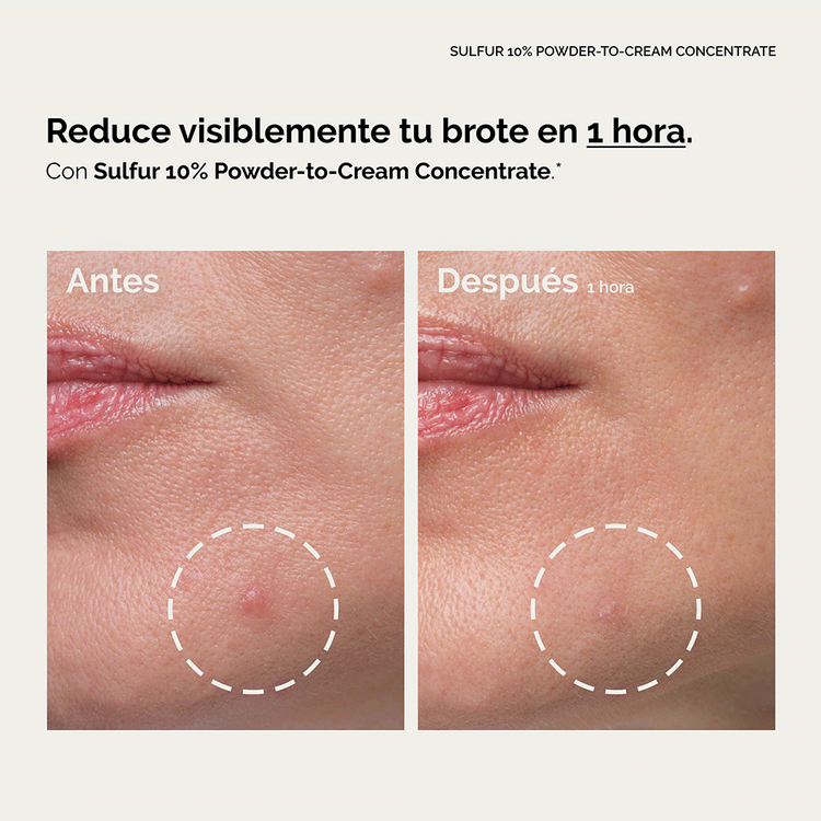 Sulfur 10% Powder-To-Cream - Concentrado de azufre, para tratar brotes y reducir imperfecciones