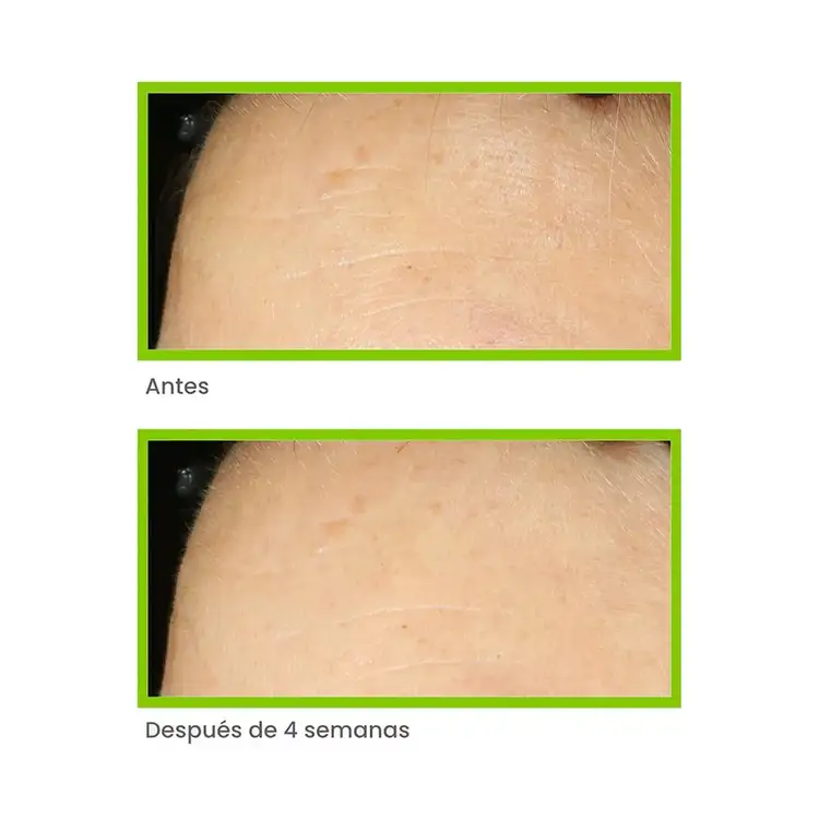 Antiedad- Retinol Youth Renewal Night Cream Crema antiedad minimiza líneas de expresión